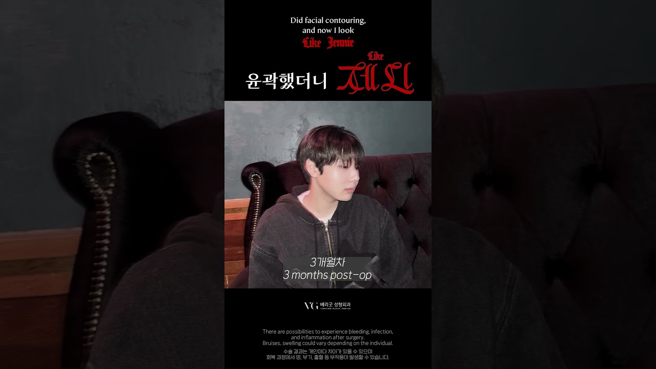 [貝麗固整形外科診所] 輪廓和臉型像珍妮