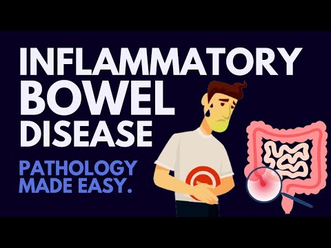 Inflammatory Bowel Disease I Pathology Made Easy