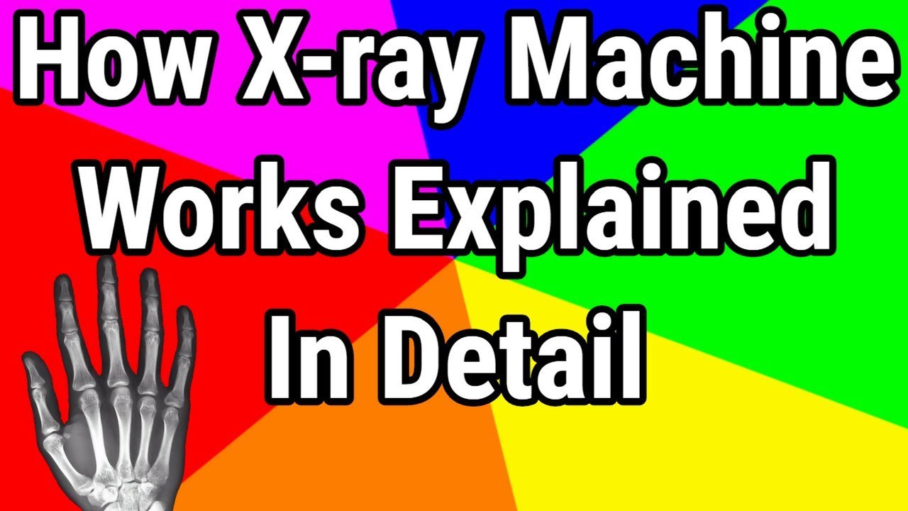 How X-ray machine works?