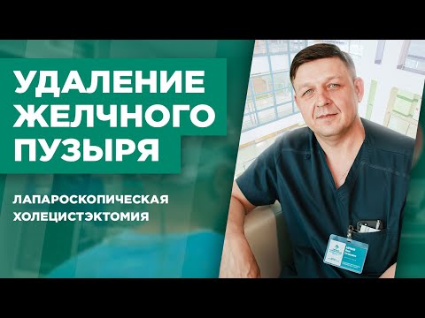 Удаление желчного пузыря (лапароскопическая холецистэктомия)