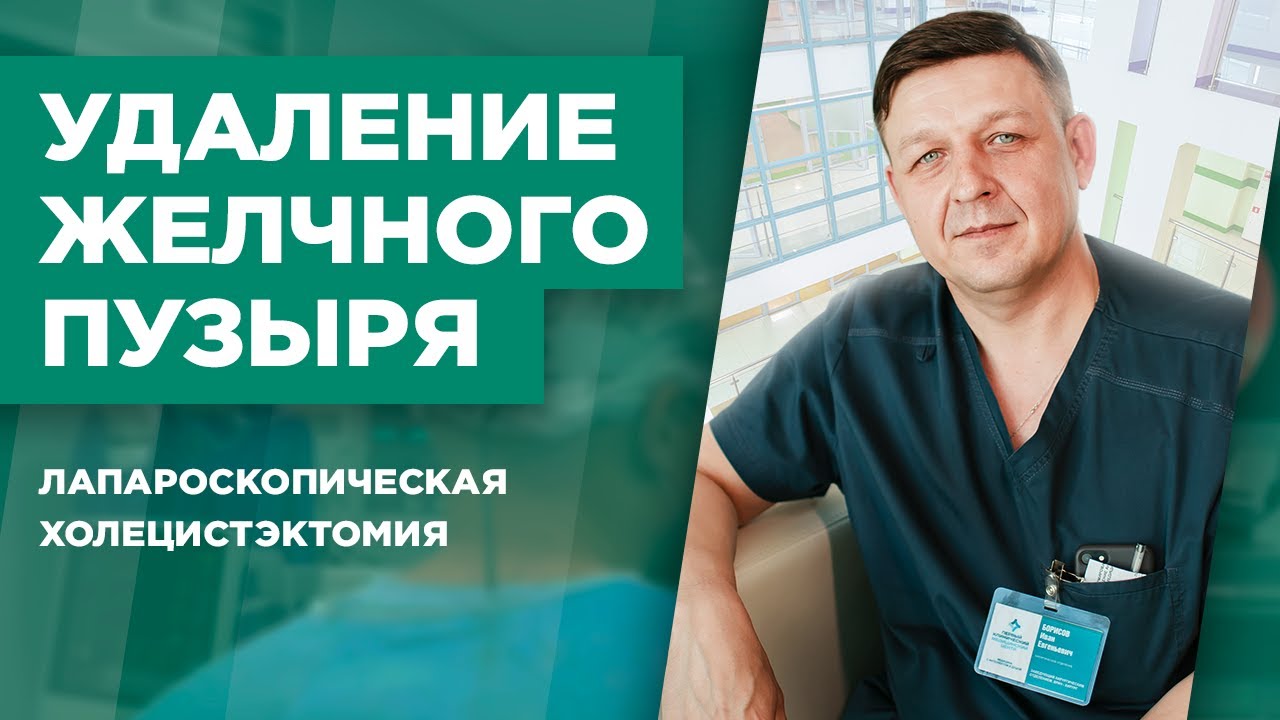 Удаление желчного пузыря (лапароскопическая холецистэктомия) - YouTube