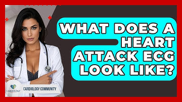What Does A Heart Attack ECG Look Like? - Cardiology Community