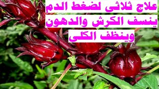 علاج ثلاثى لضغط الدم يتخلص من الكرش والدهون الضاره وينشط الكلى #الكركديه