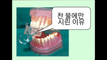 찬 물만 잇몸  / 치아가 시린 이유? (뜨거운 건 괜찮아! )       강창용