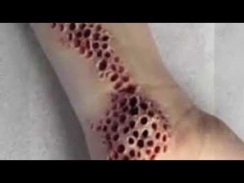 閲覧注意 トライポフォビア 7 Youtube 閲覧注意 トライポフォビア 7 Youtube