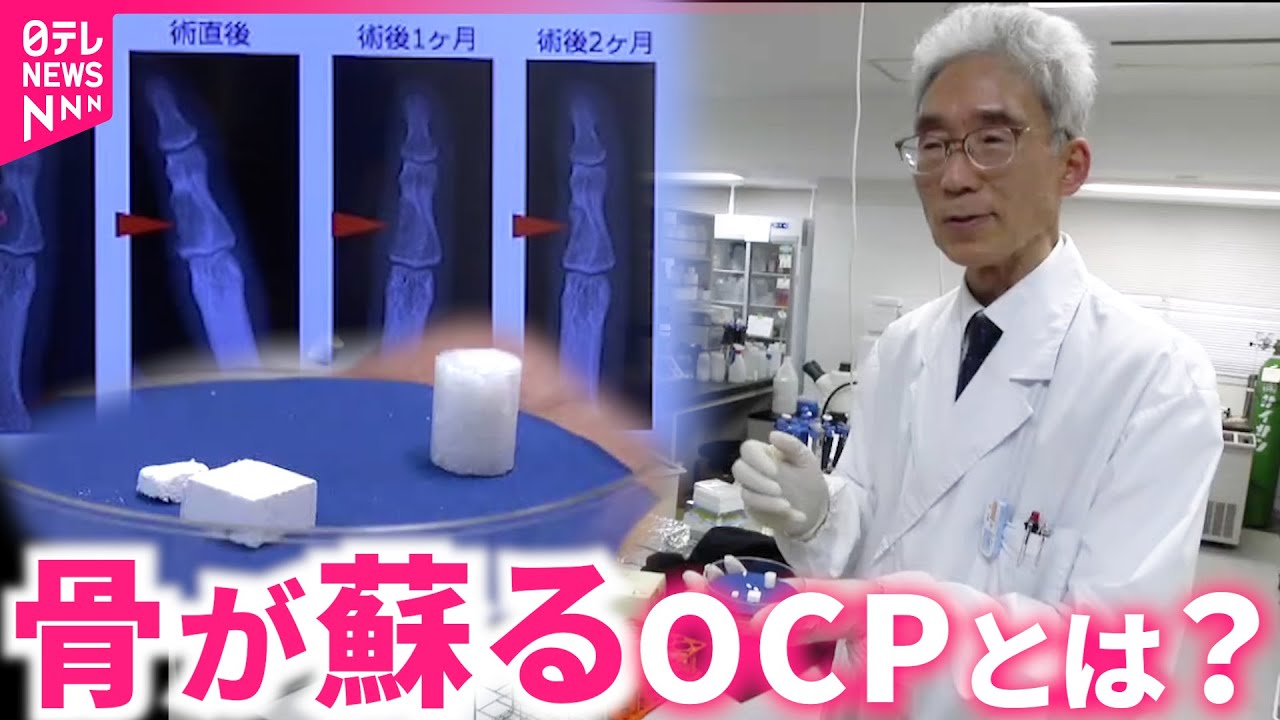 最新研究】失った骨が蘇る！