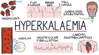 Understanding Hyperkalaemia (High Potassium)