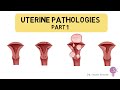 Uterine pathologies part 1