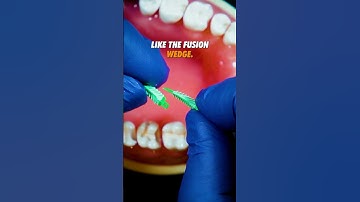 Which is the best type of wedge for Class II restorations?
