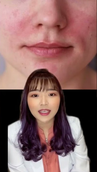 💛 TIPS SAAT ALERGI SKINCARE!! dr. Anita Ang