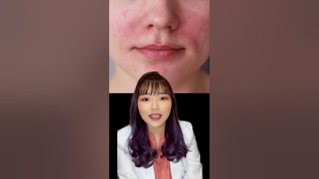 💛 TIPS SAAT ALERGI SKINCARE!! dr. Anita Ang