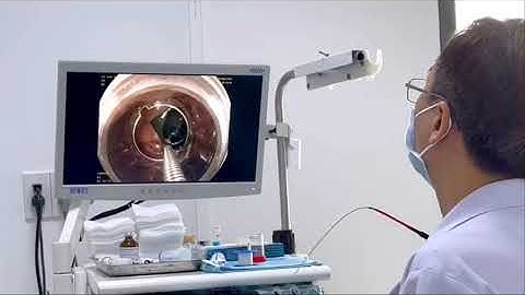 Nội soi gắp dị vật