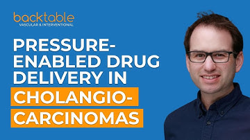 Drukgestuurde medicijnafgifte bij grote heterogene cholangiocarcinomen