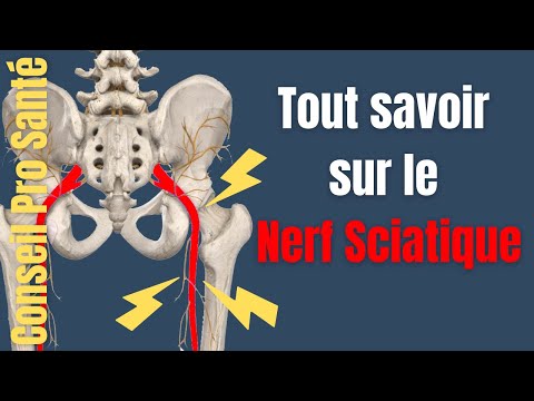 Tout savoir sur le nerf Sciatique : Origine, trajet, fonctions