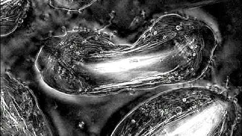 Meiosis I, Polarized Light Microscopy. J LaFountain and R Oldenbourg/MBL Woods Hole