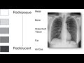 Differences Between Radiolucent And Radiopaque in X-rays imaging
