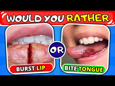 Would You Rather...