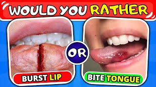 Would You Rather... Pain Edition
