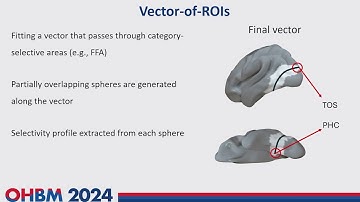 OHBM 2024 | Oral Session | Davide Cortinovis |  Category-selectivity, again: Hand-selective Visual…