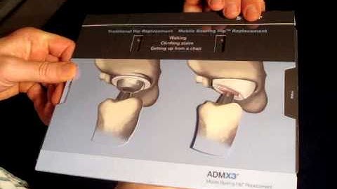 Stryker Hip Action replacement