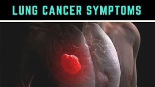 ▓ Lung Cancer █  Life Expectancy █  Causes Types █  Symptoms  ✫ Stages  ✔