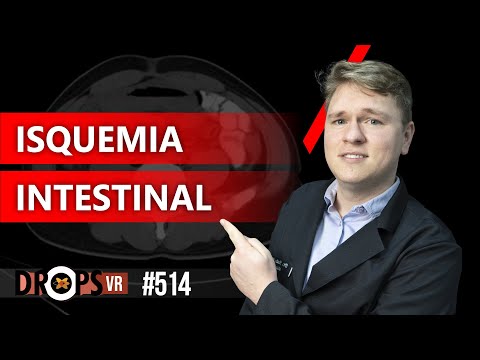 ISQUEMIA INTESTINAL: COMO