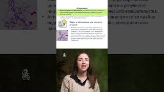 Актиномикоз - что это? #playlistэндоскописта #актиномицеты #эус #эрхпг