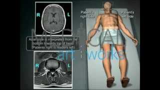 Medical Animation | Understading orientation of MRI and CT scans - How to read radiology MRI