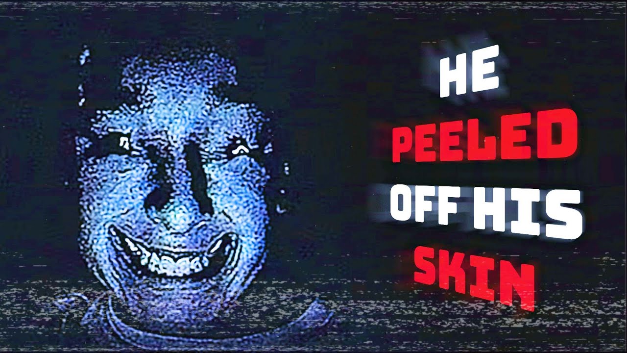 The HORRIFIC Infection That Will WIPE OUT Humanity...