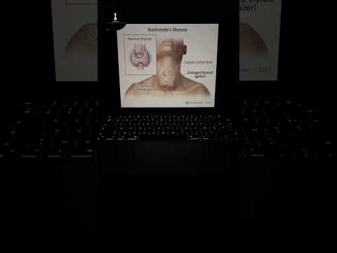 دواء الغدة و خطر الإصابة بالسرطان
