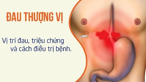 Bị đau o chấn thủy là bị gì