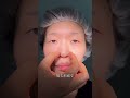 【全顔整形】衝撃すぎる結末!?#shorts