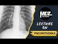 Pneumothorax Explained | Types, Causes, and Management | MRCS A & Medical Students