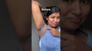 Dark Underarms Remove Homeremedy/Underarms Cleaning Tips, No MoreDark Armpit#ytshorts#viral