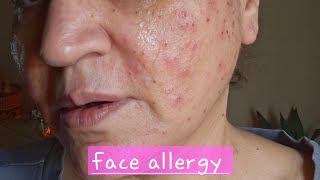 Sorry For Disconecting