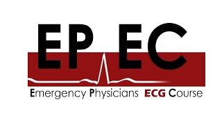 #EPEC ECG Cases (Case 09), Can you tell why this patient fainted