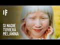 ¿Qué pasaría si todos fuéramos albinos?