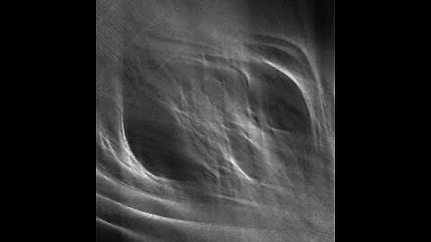 CT image reconstruction - thorax