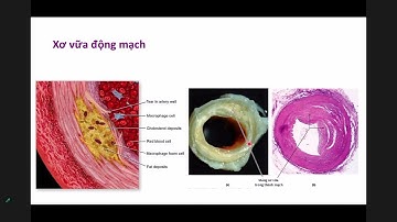 Module tim mạch: Mô