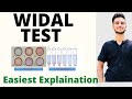 Widal Test in Hindi / Widal Test procedure / Widal Test