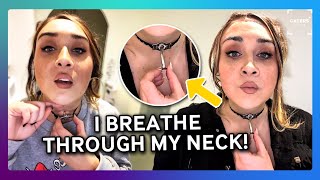 What It’s Like to Breathe Through a Hole in Your Neck