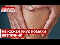 ПОПУЛЯРНІ ПОРАДИ З ІНТЕРНЕТУ МОЖУТЬ НАШКОДИТИ! ЯК ПРАВИЛЬНО ЛІКУВАТИ УКУСИ КОМАХ