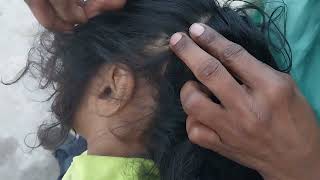 Nitpicking Asmr Video 289