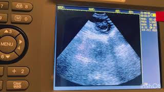At home ultrasound machine to count puppies