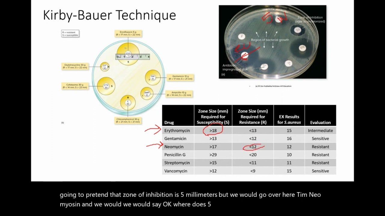 Kirby Bauer: Testing for Drug Susceptibility