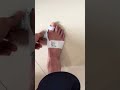 Flexible Bunion Corrector 