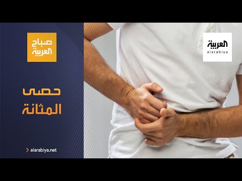 صباح العربية | ما هي أعراض حصى المثانة؟