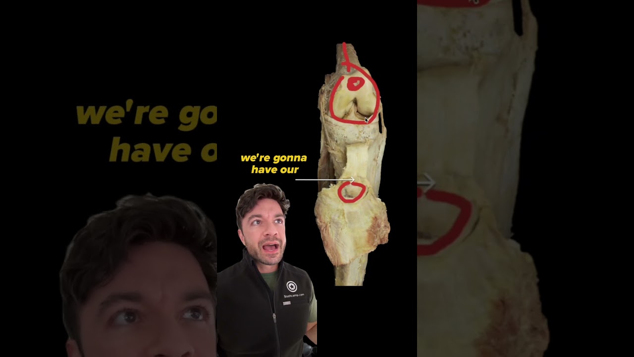 Anatomy of the Knee | Can you identify this structure? | Med School Bootcamp