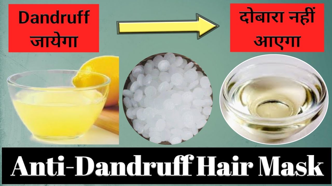 How to Reduce Dandruff at Home DIY Antidandruff Hair Mask Visible