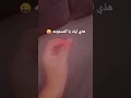 هدي ليك يا المسمومه هدي ليك يا المسمومه